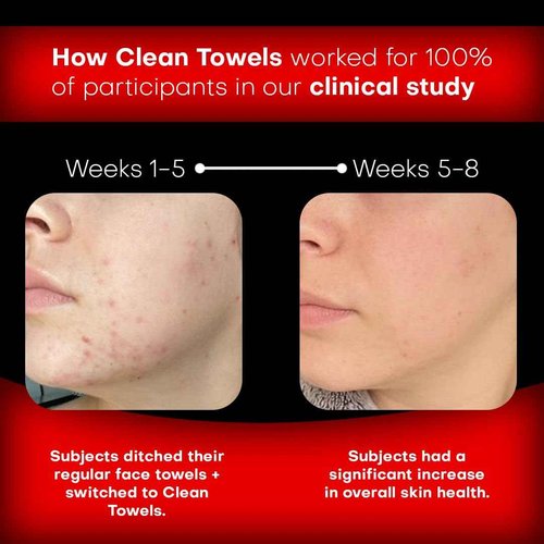 Dirty to Flirty Face Towels | XL 8x8 Ultra Soft & Extra Thick Facial Wipes | Disposable Face Towelettes for Sensitive Skin | Dry Face Cloths for Makeup Remover, Travel & Skincare | 60 count