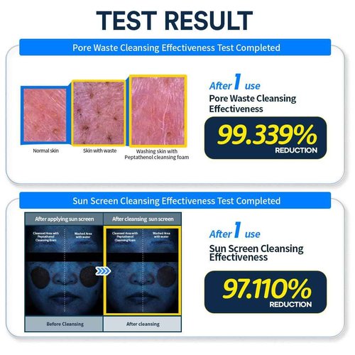 ANOTHERFACE PEPTATHENOL™ Aqua Balance Cleansing Foam 5.07 Fl. Oz., Peptied, Panthenol, Daily Low pH Facial Deep Cleanser, Hydrating Bubble Foam, Korean Skin Care, Mild for Sensitive Skin, Vegan