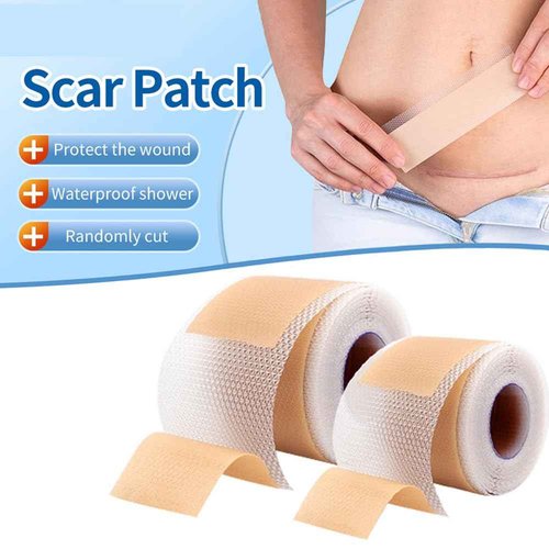 Medical Grade Silicone Scar Sheets 1.6"x 157" Roll-4M Keloid Scars Removal C-Section Scar Strip Painless Treatment Resuable Tummy Tuck Tape Professional for Surgical Incision,Acne,Burn Scar