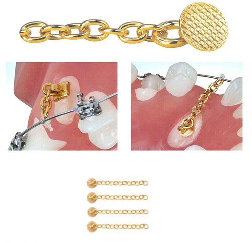 4 Pcs New Golden Traction Chain Dental Lingual Button Chains Orthodontics Materials Swivel Chain Dental Impacted Cuspid Eruption Appliance