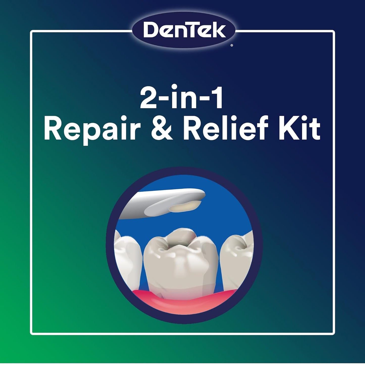 DenTek Temparin Max Advanced Dental Repair Kit, 13+ Repairs