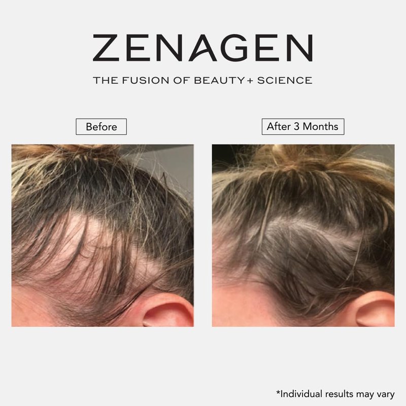 ZENAGEN Revolve Women's Thickening Shampoo | Supports Appearance of Fuller, Healthier-Looking Hair, Developed for Fine & Visibly Thinning Hair, Plant-Based, 5-Minute Treatment, 473 mL / 16 oz