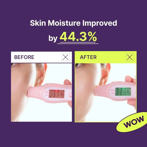 TIA'M Snail & Azulene Calmfort Cream, 3.38 fl oz, 92% Snail Mucin, Lightweight Calming & Moisturizing Cream for Soft, Glass Skin, Korean Skin Care, Day & Night Moisturizer Face Cream