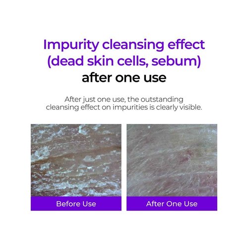 IZEZE Hyper CSA Cica Cleanser 5.07 fl.oz, 150 ml | Salicylic Acid Foaming Wash, Centella Asiatica Face Wash, Facial Deep Rich Foam, Facial Foam for Sensitive and Acne Prone Skin, Skincare Coreano