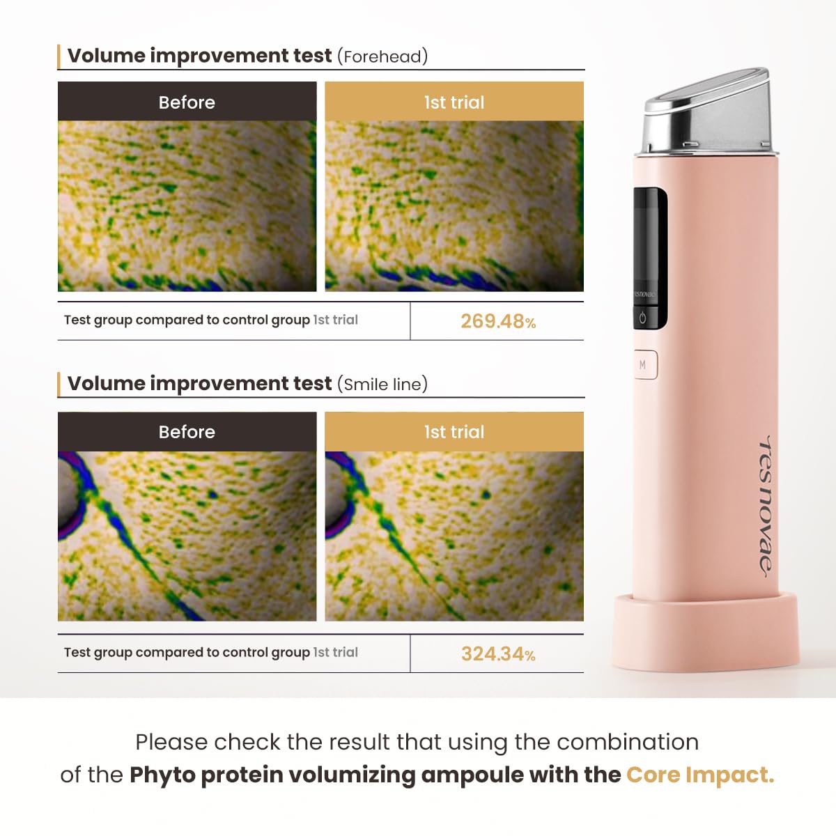 res novae Plumping Serum – 30ml (1.01 fl oz) – Visibly Firms Skin, Boosts Radiance, Enhances Tone, Deep Hydration with Peptides & Botanical Extracts