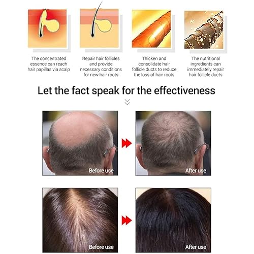 Magic Hair Growth Tonic with Ginseng ? 60ML Hair Loss Treatment for Men & Women, Fast Hair Regrowth Serum for Thicker, Fuller Hair
