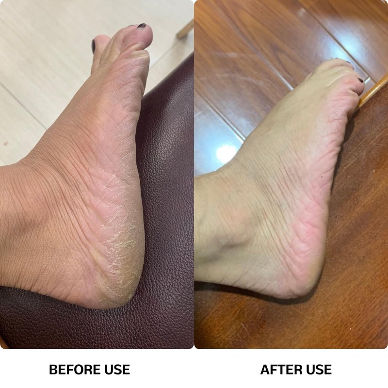 High Power Electric Foot Callus Remover, 2026 Upgrade with 100-inch Extra-Long Cord and 60 Replaceable Sandpaper Discs, Electric Foot File for Cracked Heels and Dead Skin, Black