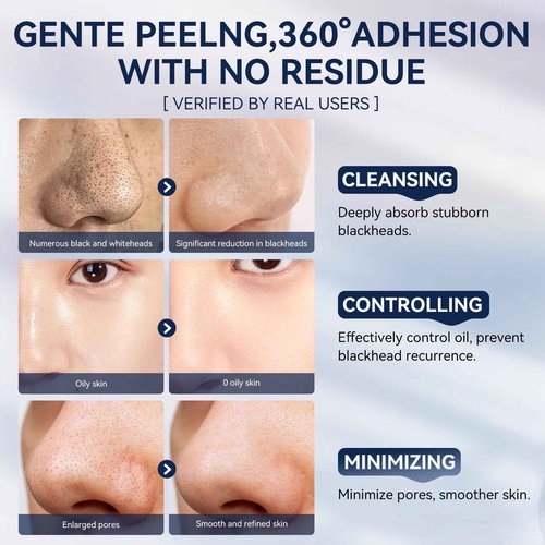 LANBENA 3 in 1 Blackhead Removing Set, Pore Strips 30g+Pore Serum 30ml+Removal Strip Paper, Black Head Remover Mask for Face, Pore Minimizer & Reducer for Face, Leaving Your Skin Fresh and Clean