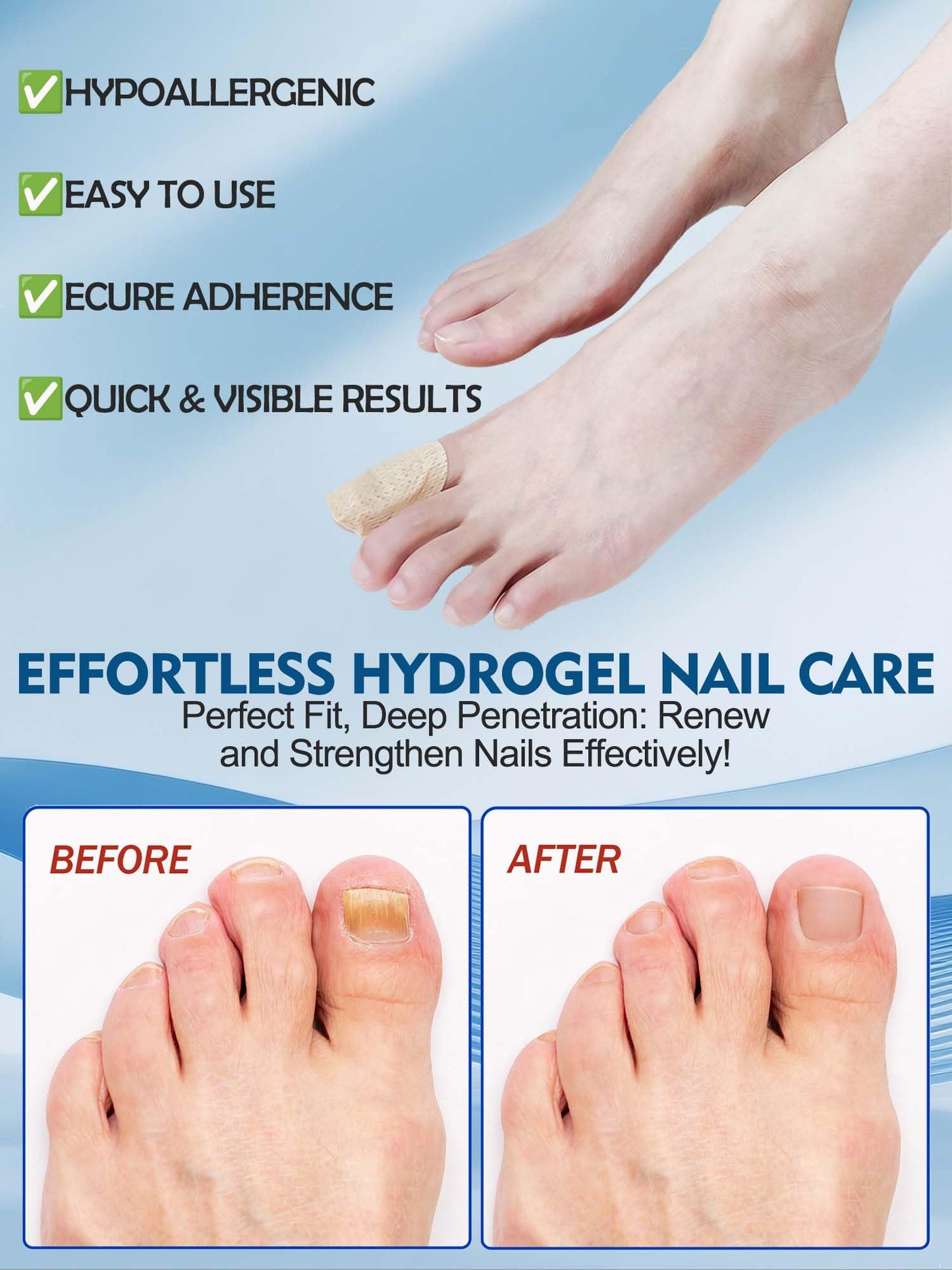 Nail Patches Toenail Treatment Extra Strength 8-Hour Overnight Nail Fast Acting Repair Effortless Hydrogel Nail Care and Repair for Damaged Nails Overnight Renewal for Men and Women (48 Count)