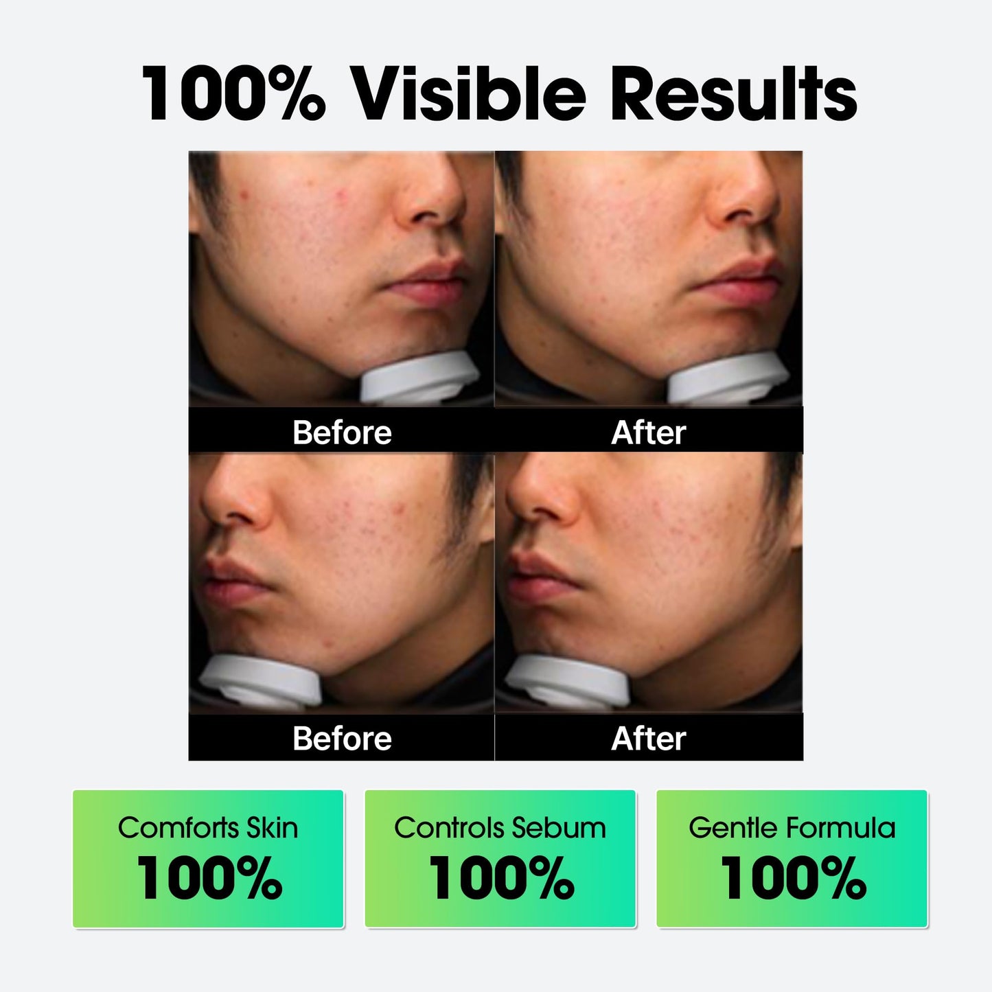 SOME BY MI AHA BHA PHA Miracle Cream – 2.02oz – Centella Care