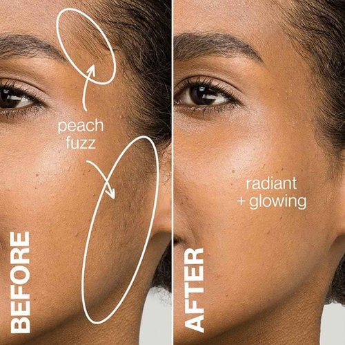 BONDI BLADES - Starter Kit - 3 Pack Dermaplaning Razors & Aloe Vera Shave Gel - Dermaplane Razor - Eyebrow Razor - Dermaplaning tool for Face - Facial Razor for Women - Peach Face Remover