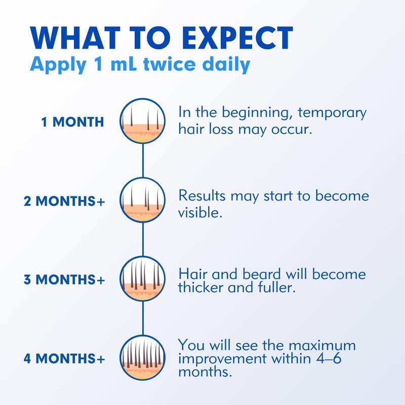 5% Minoxidil for Men Hair Regrowth Treatment, Extra Strength Topical Solution for Thinning Hair & Balding, Beard Growth Enhancer, Non-Greasy Fast-Absorbing Formula, 4-Pack (240ml) 4-Month Supply