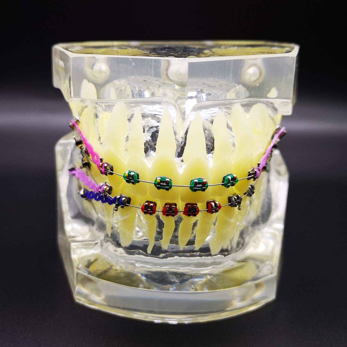 Dental Typodont with Metal Brackets Orthodontic Teeth Model with Ligature Tie