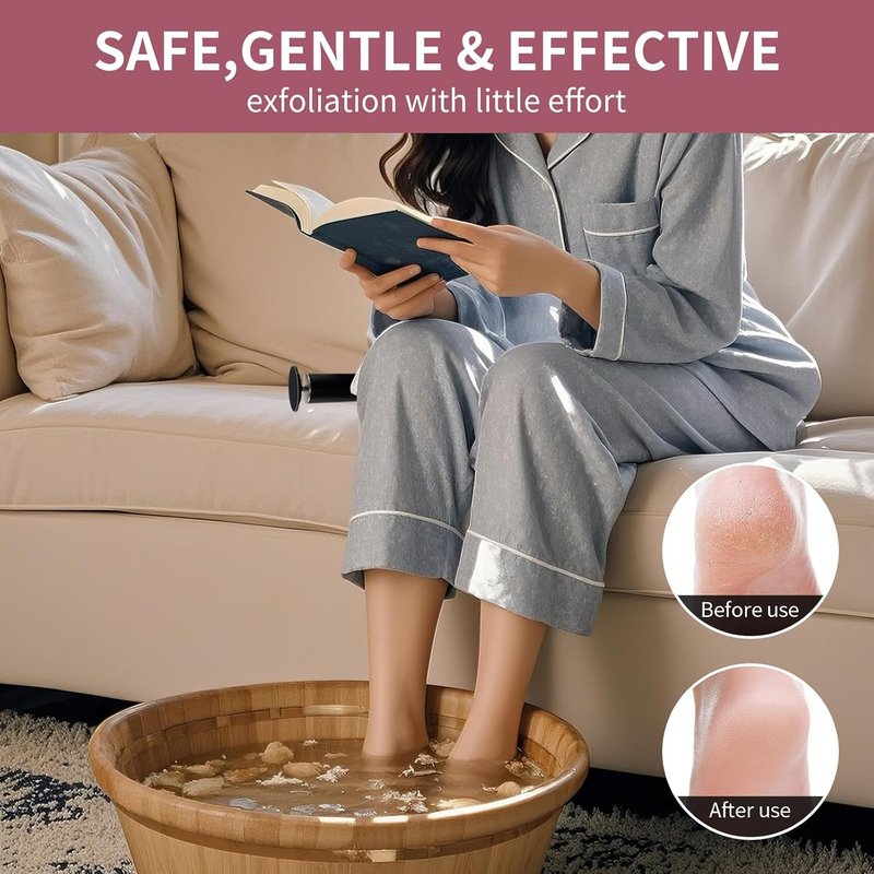 Electric Foot Callus Remover - Adjustable Speed, Low-Noise Pedicure Tool for Thick Dry Skin & Cracked Heels | Easy-to-Clean Home Device