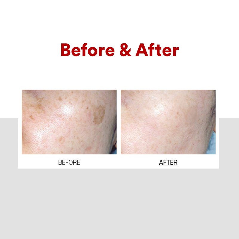 Medi-Peel Melanon X Cream 1.01 fl oz, Reduce Dark Spots, Anti-Aging, Spot Cream, Spot Treatment, Skin Trouble Care, Brightening, Moisturizing, Blemish & Freckles, Korean Skin Care