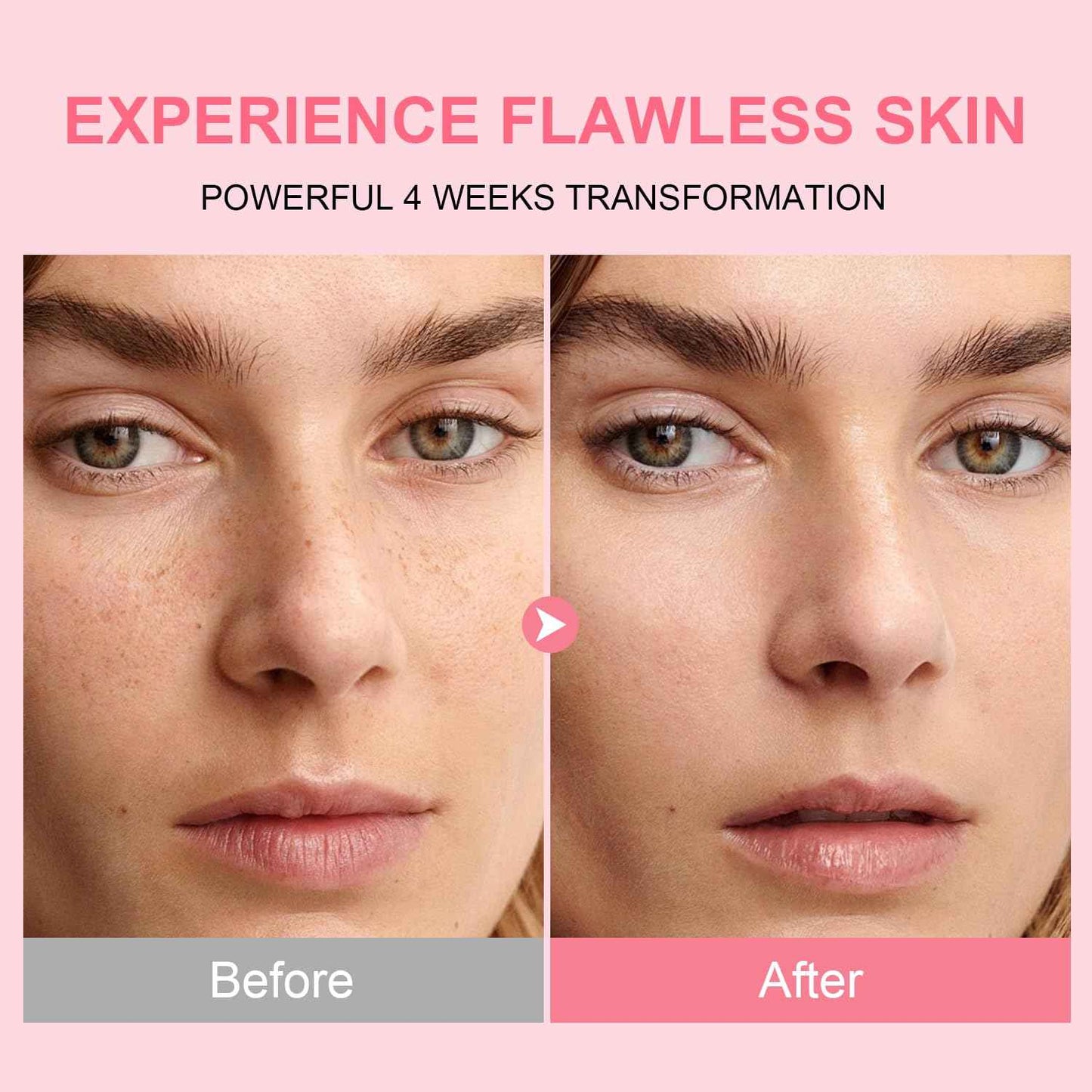 AVJONE Niacinamide 10 + TXA 4 Serum, Facial Serum for Glass Skin, Clarifying, Radiant Complexion with Natural Color - Vegan Paraben Fragrance Cruelty Free (30ml /1.01 fl.oz)