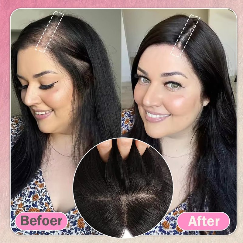 Unipearl Hair Toppers for Women Real Human Hair 12 Inch 360° Cover Remy Human Hair Topper for Women with Thinning Realistic Scalp Clip in Pieces Straight Hair (Light Brown #6, Side Bangs)