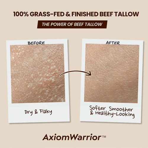 Beef Tallow and Honey Balm for Skin: Whipped Organic Beef Tallow Moisturizer Cream for Face & Body with Grass Fed & Finished - Hydrates, Nourishes & Smoothes - Sensitive, Dry Skin - 2oz
