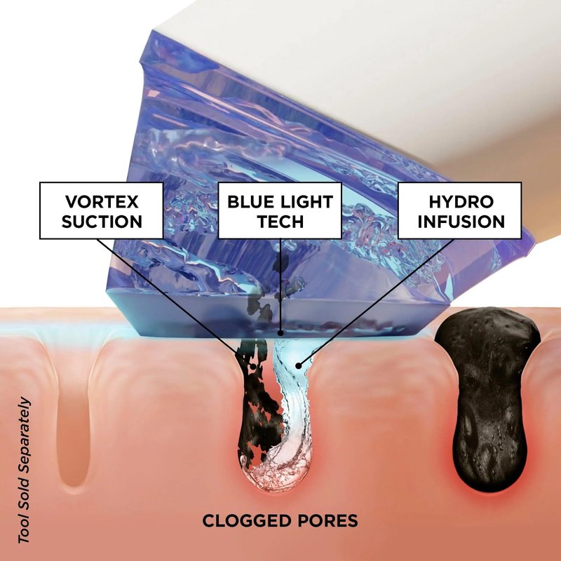 BeautyBio GLOfacial Hydro-Infusion Deep Pore Cleansing + Blue LED Clarifying Tool & Concentrates