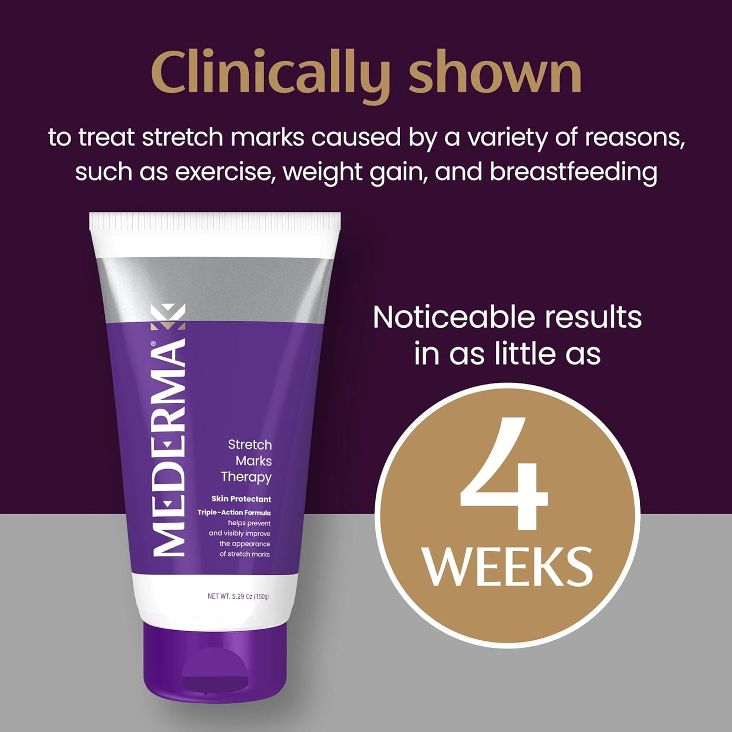 Mederma Stretch Mark Therapy Cream - Prevent & Treat Stretch Marks | Safe for Pregnancy, 5.29 oz (150g)