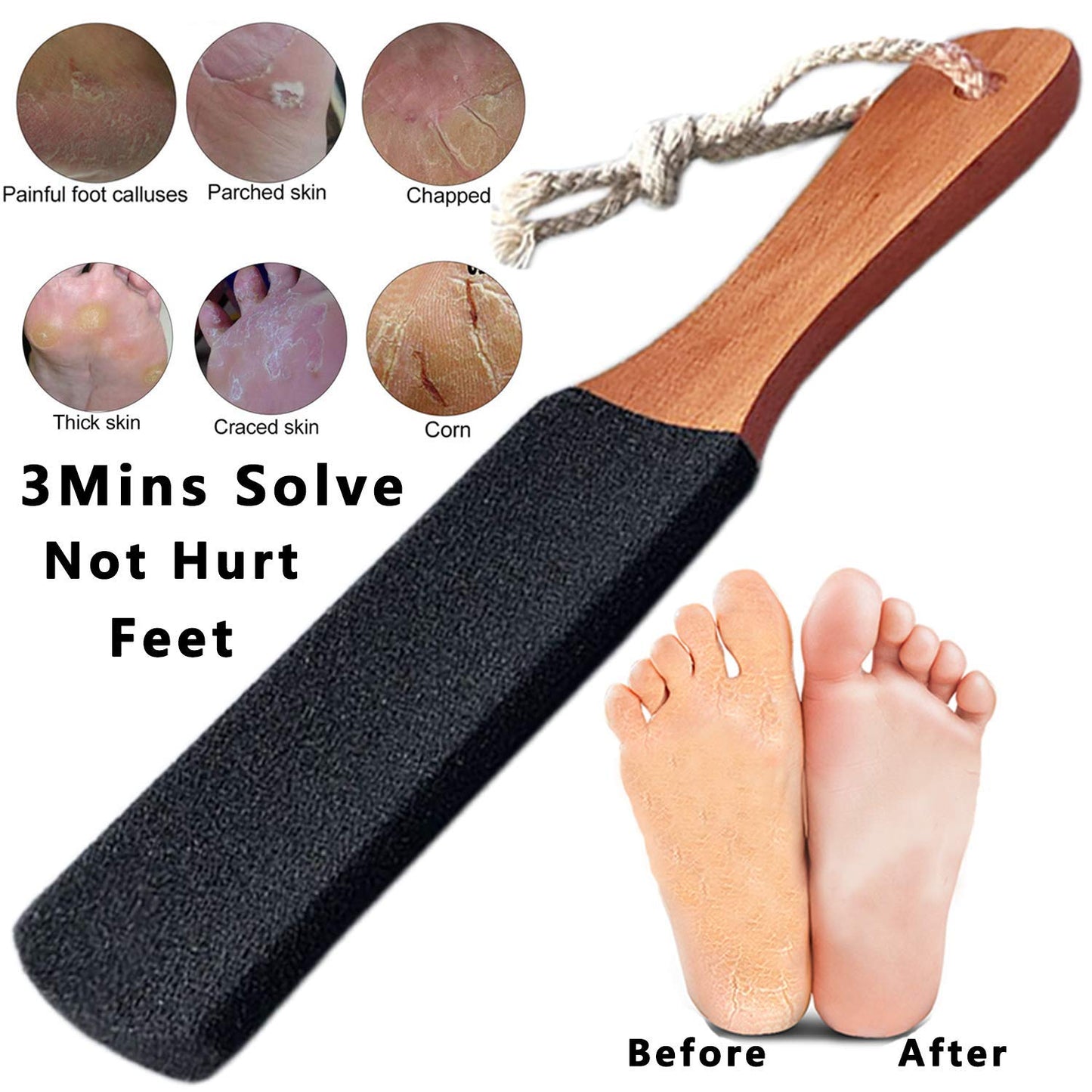 LEKESI Foot File Callus Remover Foot Scrubber,Professional Pedicure Foot Rasp Removes Cracked Heels,Dead Skin,Corn,Hard Skin,Pumice Stone for Feet Scraper File Brush Tools for Wet and Dry Feet