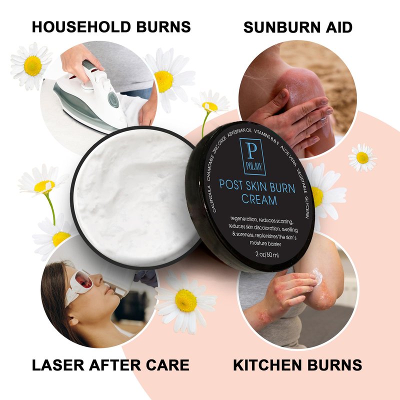 PolJoy Post Skin Burn Cream, Sunburn Cream for First Aid Treatment, Hydrates & Repairs Skin with Aloe Vera, Shea Butter, Zinc Oxide, Calendula, Coconut Oil & Vitamins B&E, Kitchen & Travel Use