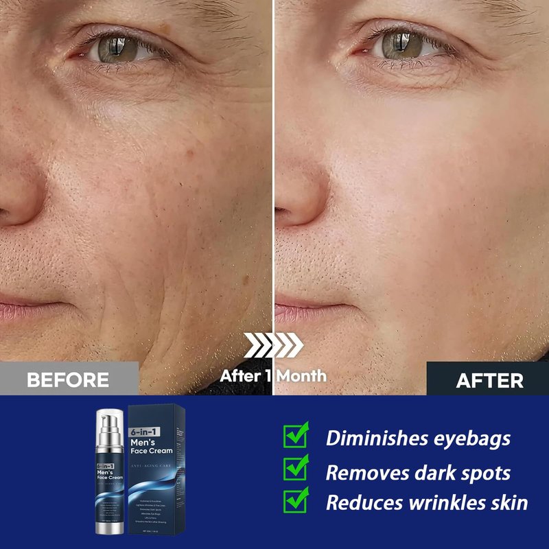 6 in 1 Face Cream for Men – Anti Aging Men’s Moisturizer with Collagen, Hyaluronic Acid and Shea Butter – Daily Skin Care – Reduce the Look of Eye Bags, Dark Circles and Puffiness – 1.76 fl oz (1)