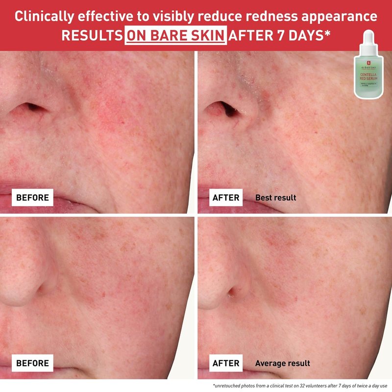 Erborian Red Serum, Daily Hydrating & Soothing Redness Treatment for Sensitive Skin, Lightweight Barrier Support with Centella, Korean Skincare