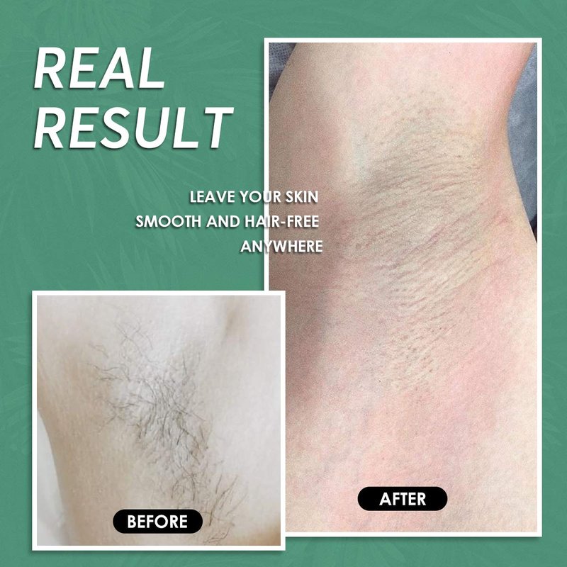Maxpearl Wax Beads for Hair Removal, 2.5lb Hard Wax Beans Refill Bag for Brazilian Bikini, Face, Eyebrows, Underarms, Arms, Chest, Back, Legs, Coarse Body Hair Specific