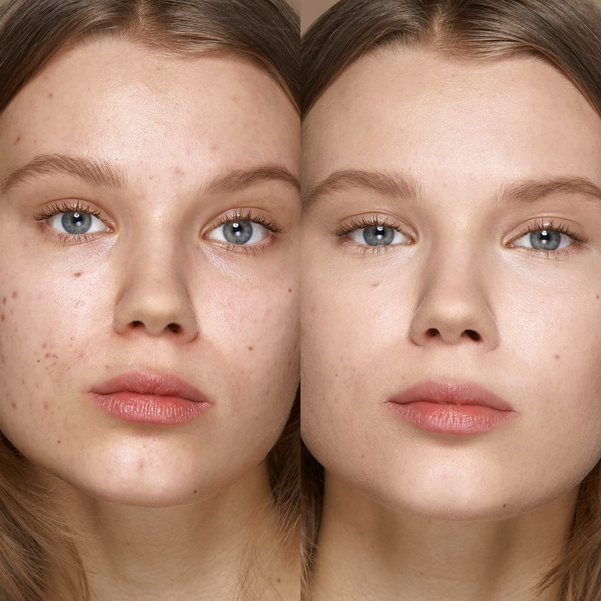 KIKO Milano Full Coverage Concealer 01 | Very High Coverage Concealer