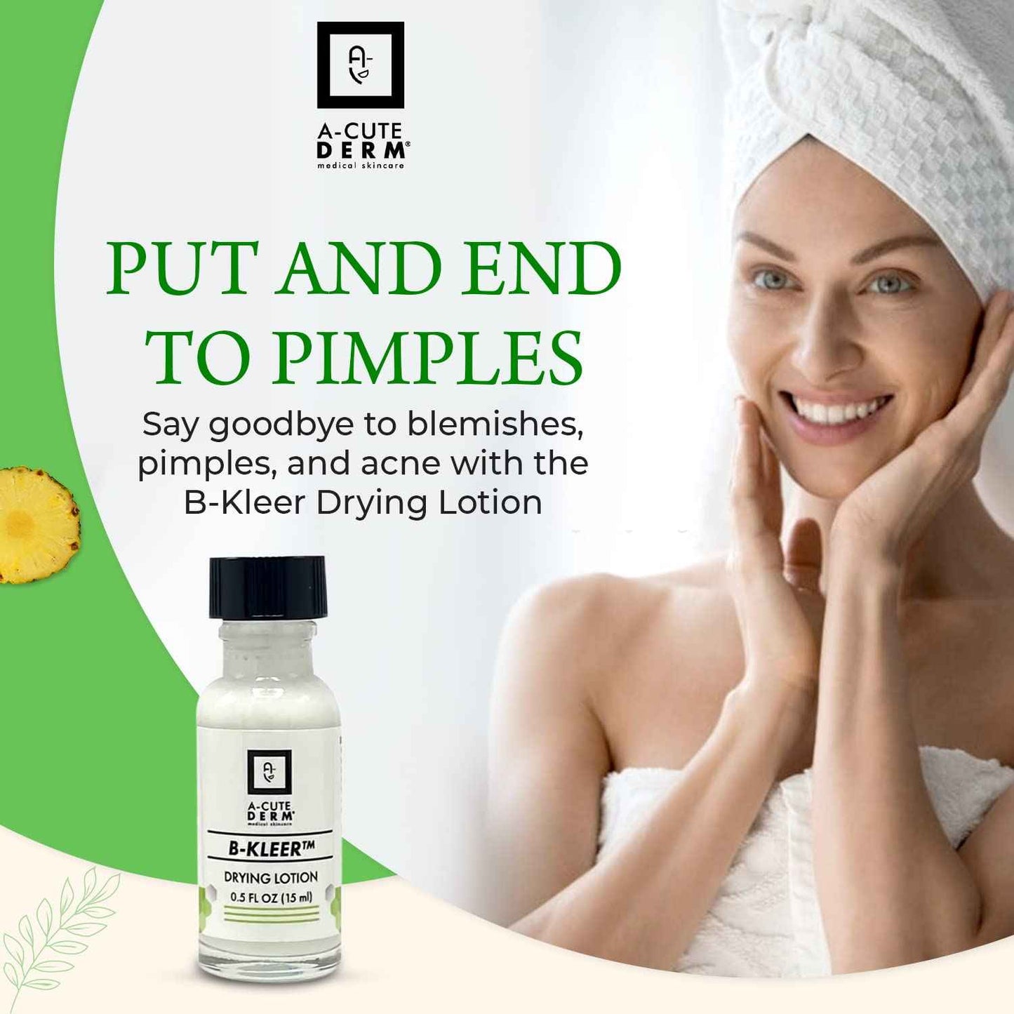 A-Cute Derm B-Kleer Drying Lotion Advanced Blemish Spot Treatment for Pimples, Razor Bumps & Oily T-Zone Fast-Acting Overnight Formula, Use Day or Night 0.5 oz