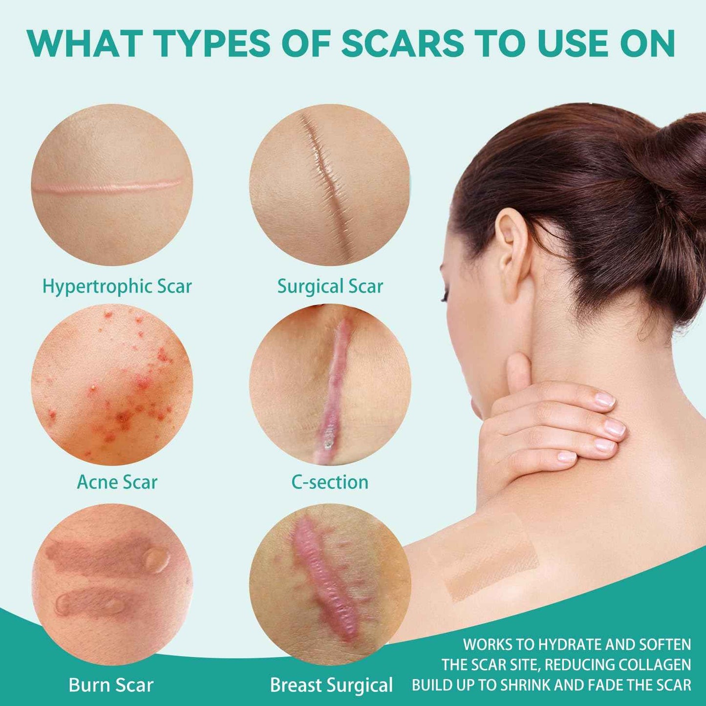 Silicone Scar Tape, Silicone Scar Sheets(1.6"X 120" Roll-3M), Reusable Medical Grade Silicone Tape for Scars, C-Section, Keloid, Acne, Tummy Tuck, Surgical Scars, Light