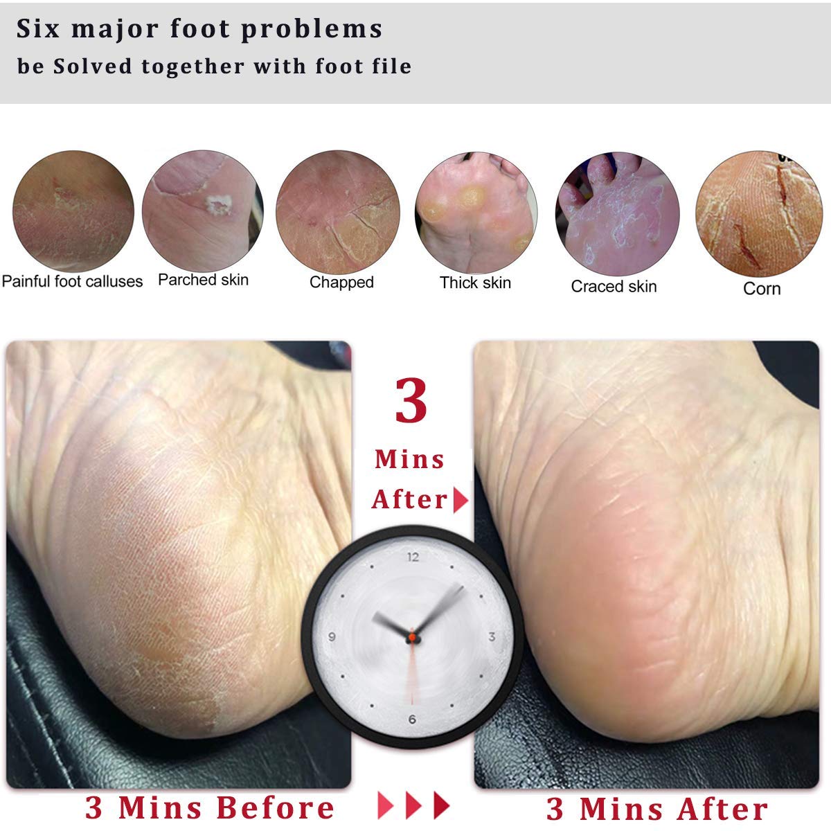 LEKESI Foot File Callus Remover Foot Scrubber,Professional Pedicure Foot Rasp Removes Cracked Heels,Dead Skin,Corn,Hard Skin,Pumice Stone for Feet Scraper File Brush Tools for Wet and Dry Feet