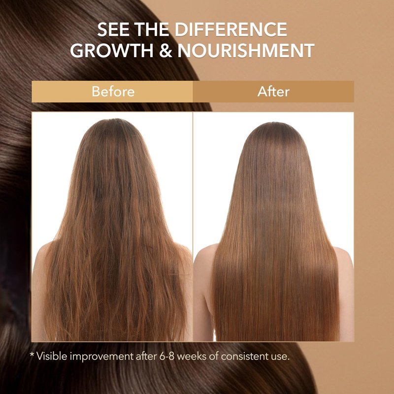 Biotin Hair Growth Shampoo for Thinning Hair in Adults 30+ – Strengthening Formula with Biotin & Rosemary – Reduces Shedding, Supports Fuller, Stronger Hair – Sulfate-Free, 16.9 fl oz