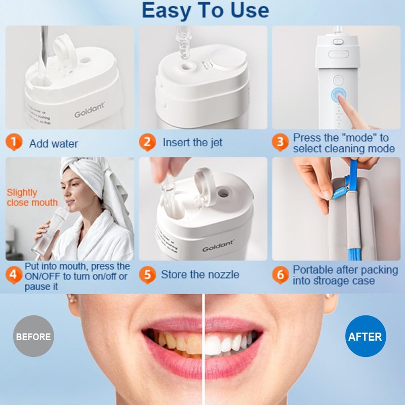 2026 New Portable Water Flosser for Teeth, 4 Modes & 4 Intensity Levels, Mini Small Design with Exquisite Travel Case, Removable Tank, IPX7 Waterproof, Cordless Dental Oral Irrigator (White)