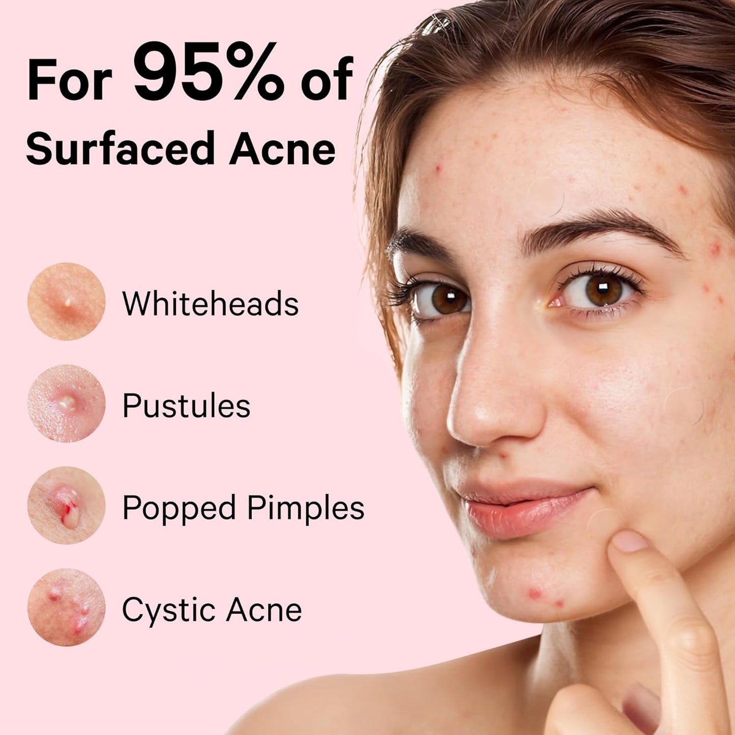 Sosky Pimple Patches for Face, Invisible Hydrocolloid Acne Patches, HSA Store Eligible Items, Zit Sticker for Face and Skin, Pimple Sticker for Covering Zits, Blemishes with Salicylic Acid 48 Count