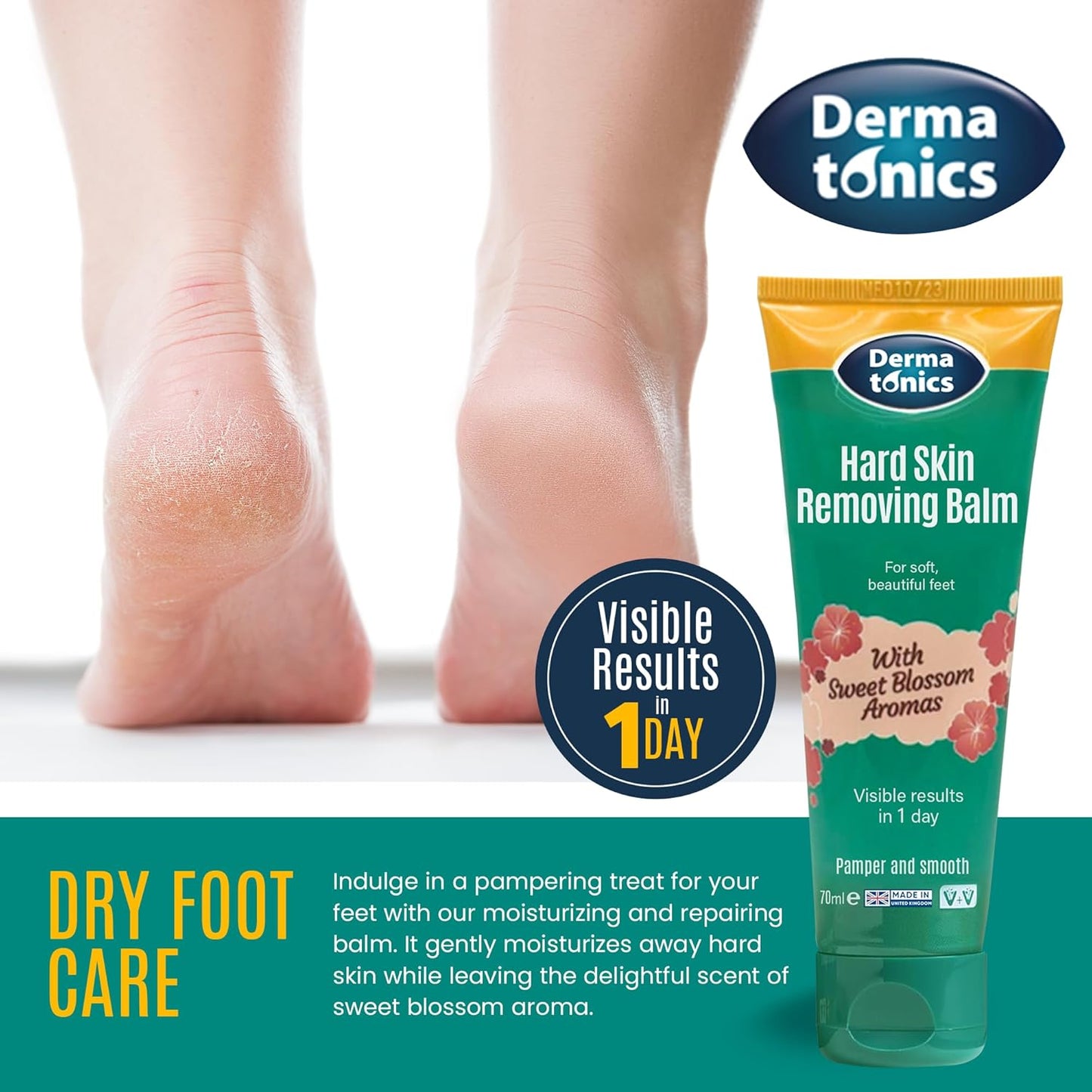 Dermatonics Hard Skin & Callus Removing Balm | 10% Urea & Sakura Blossom - Moisturizing Formula for Feet, Hands & Elbows - 2.37 fl oz Tube