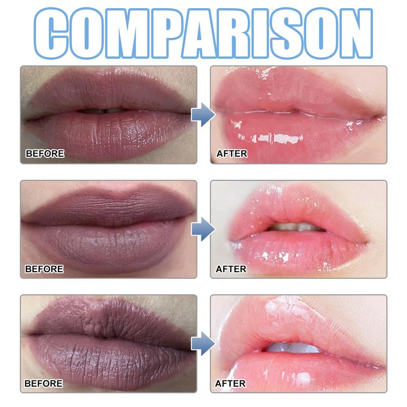 XIRUJNFD Lip Serum, Remove Dark Lips Pink Fresh Lightening Lips Treatment Lip Balm, Moisturizer Nourishing Essence Lips