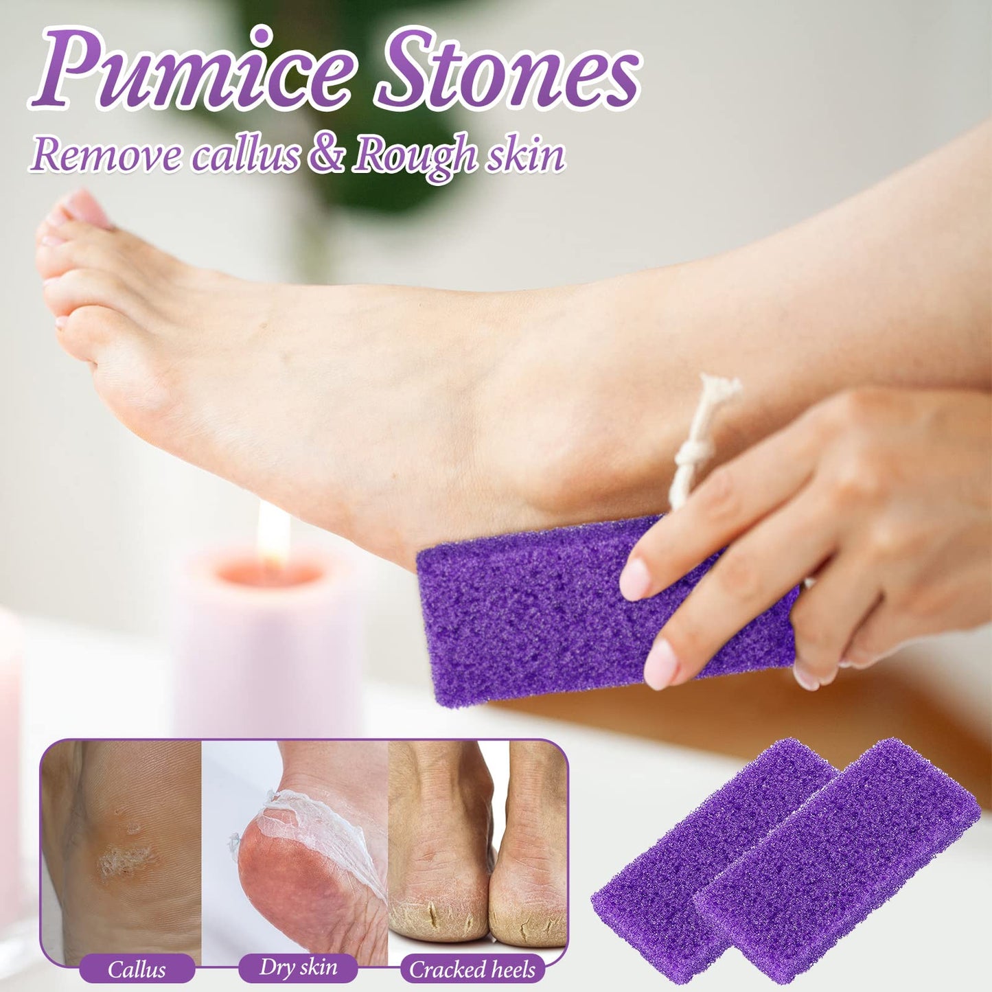 Dunzy 200 Pcs Disposable Pumice Stones for Feet, Professional Pedicure Callus Remover Blocks for Spa Salon Pedicure Supplies, Foot Exfoliating Scrubber for Dead Skin and Heel Care