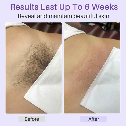 BLITZWAX 120pcs Wooden Waxing Sticks Kit for Hard Wax Hair Removal, Eyebrow Large and Small Applicators for Face, Body, and Lip, with 30 Wax Papers and Oils, Ideal for Womenโs At-Home Waxing