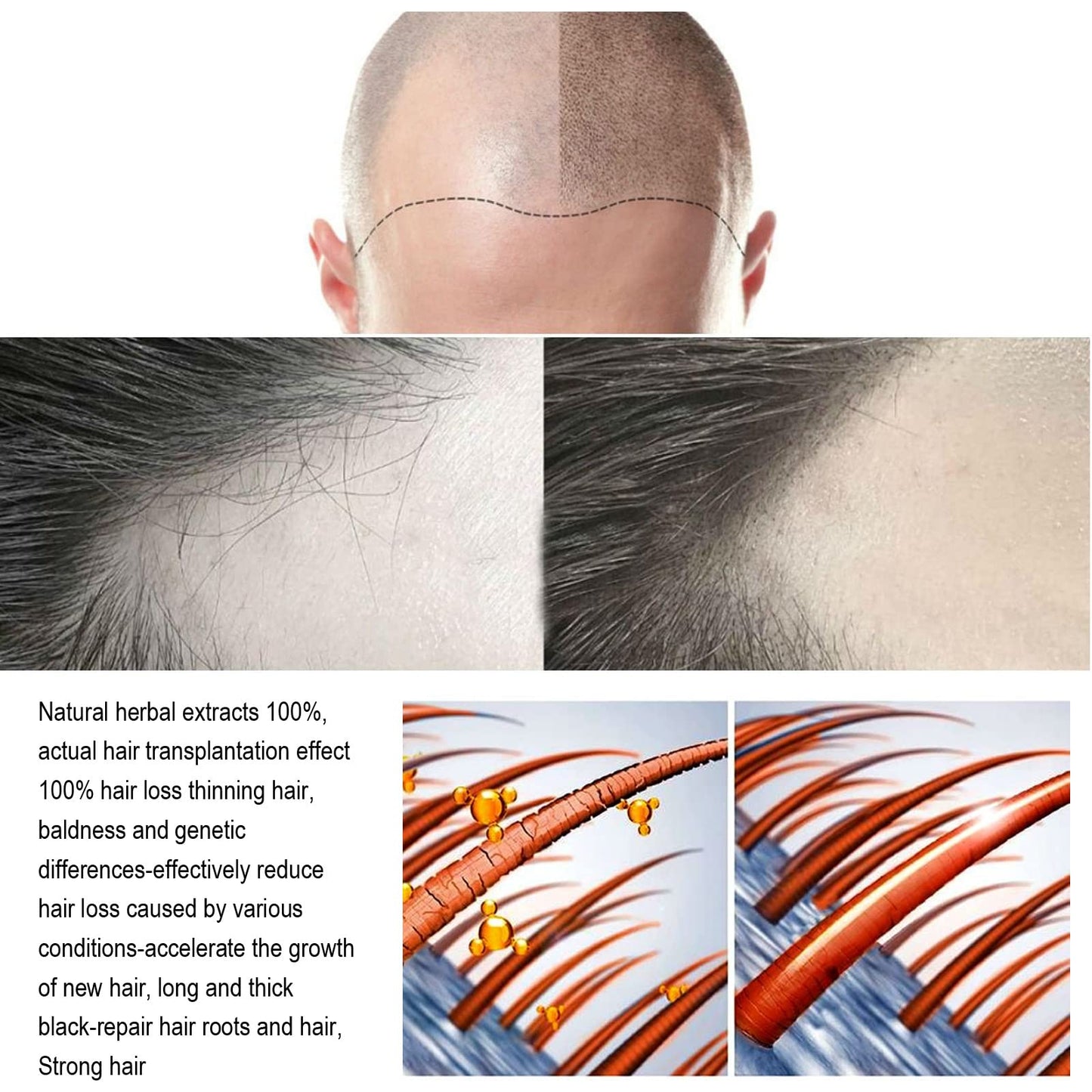 Hair Regrowth System, Advanced Hair Growth Treatment Ginseng, Eclipta Prostrata, Peppermint Oil and Ginger Root, Treatment for Thicker, Strengthens Roots,for Men and Women 1pcs