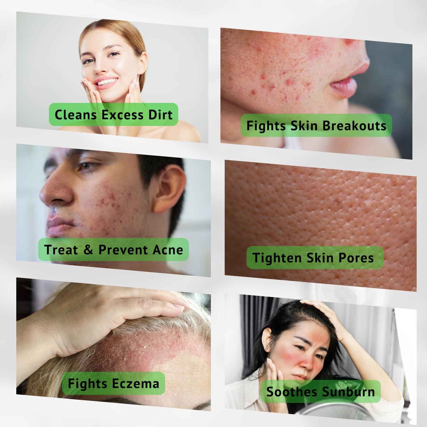 iMMense Naturals Aloe Vera Toner for Face. Skincare to Treat and Prevent Acne, Restore PH Balance & Excess Dirt. Facial Toner for Women and Men.