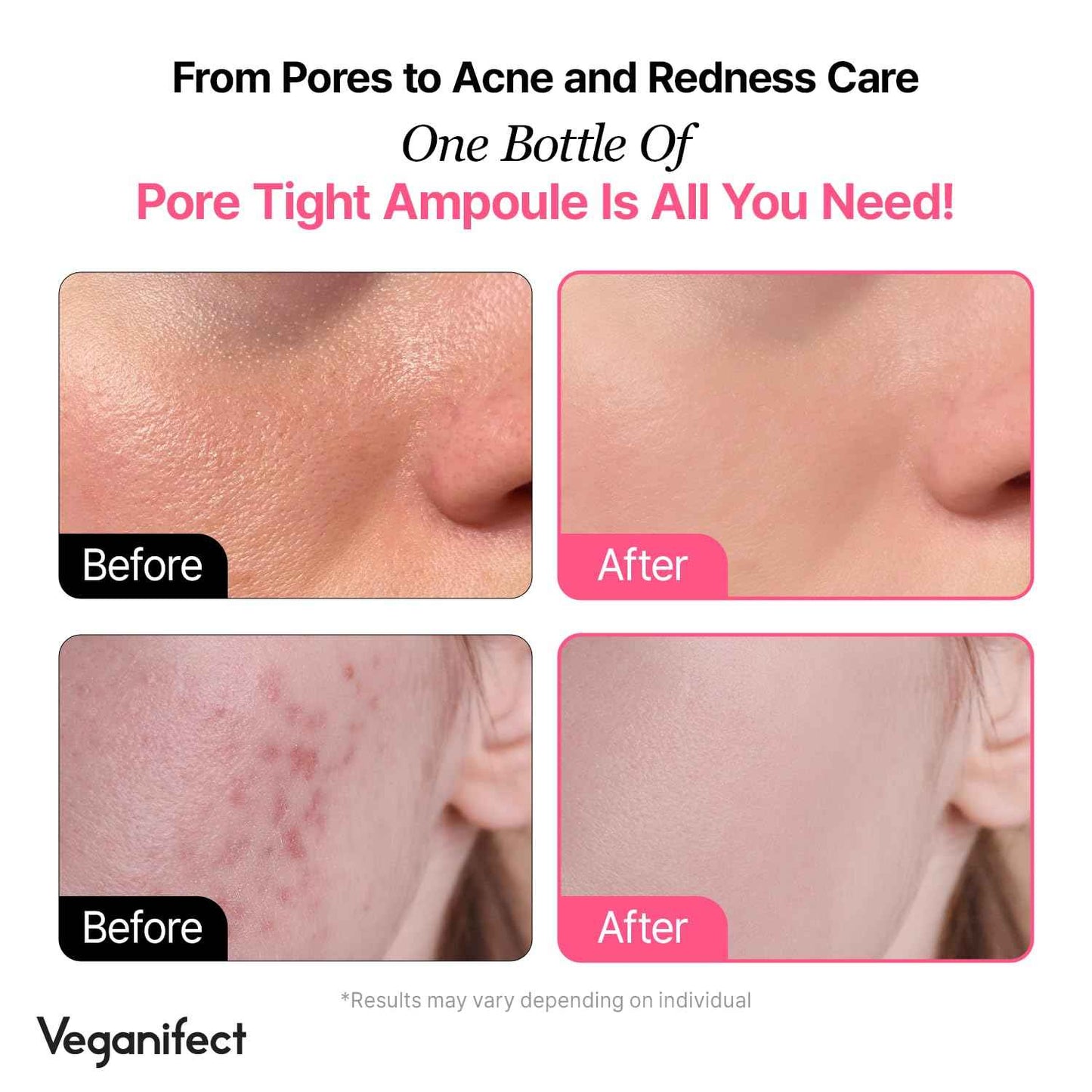 VEGANIFECT Pore Refining Ampoule, Pore Tightening, Reduce Sebum, Korean Skin Care, Vegan, 1.69 Fl Oz