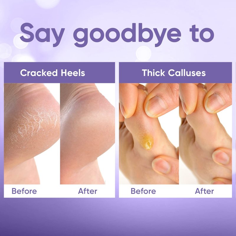 CÉLOR Foot Peeling Mask for Dry Cracked Feet | Foot Mask to Exfoliate Rough, Cracked, Dry Feet, Calluses for Soft Baby Feet Results | Made with Aloe Vera Extract for Women & Men (5 Pairs) | Lavender