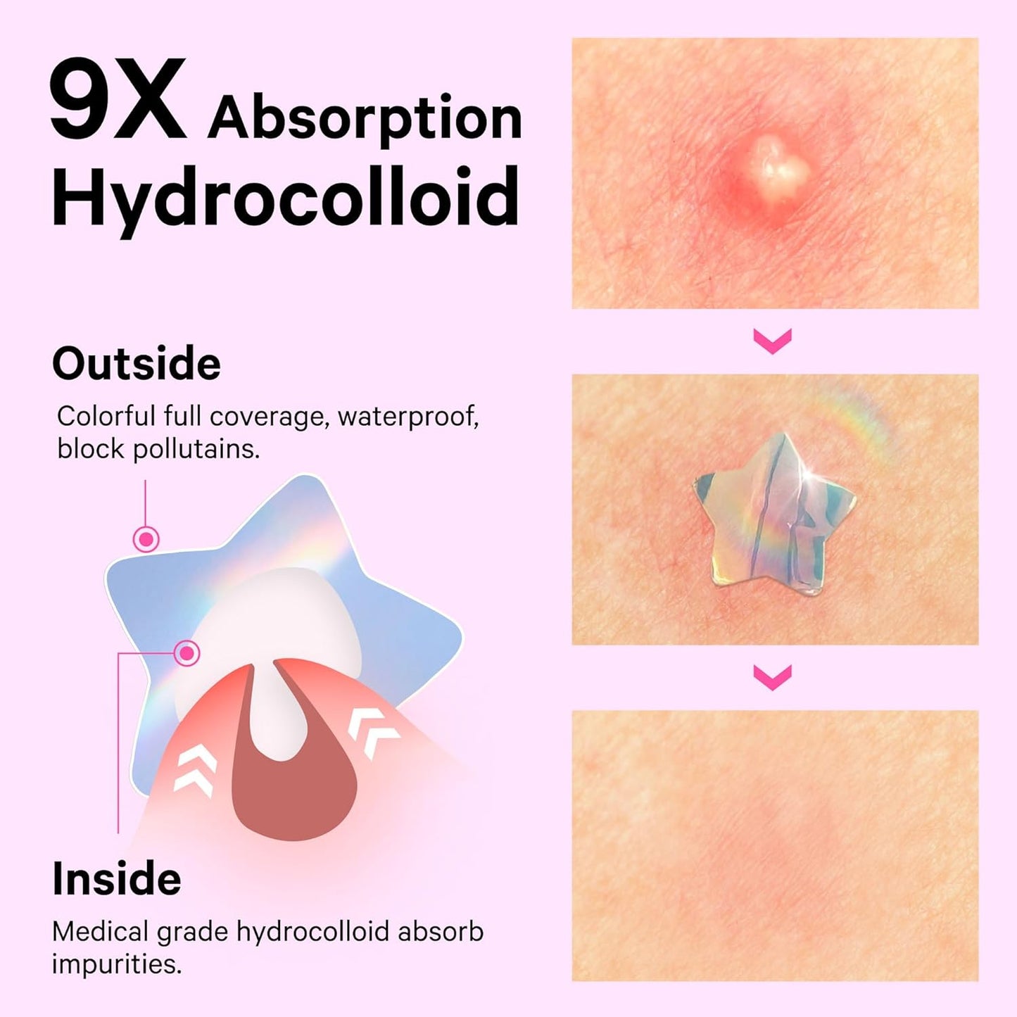 Sosky Pimple Patches for Face, Invisible Hydrocolloid Acne Patches, HSA Store Eligible Items, Zit Sticker for Face and Skin, Pimple Sticker for Covering Zits, Blemishes with Salicylic Acid 48 Count