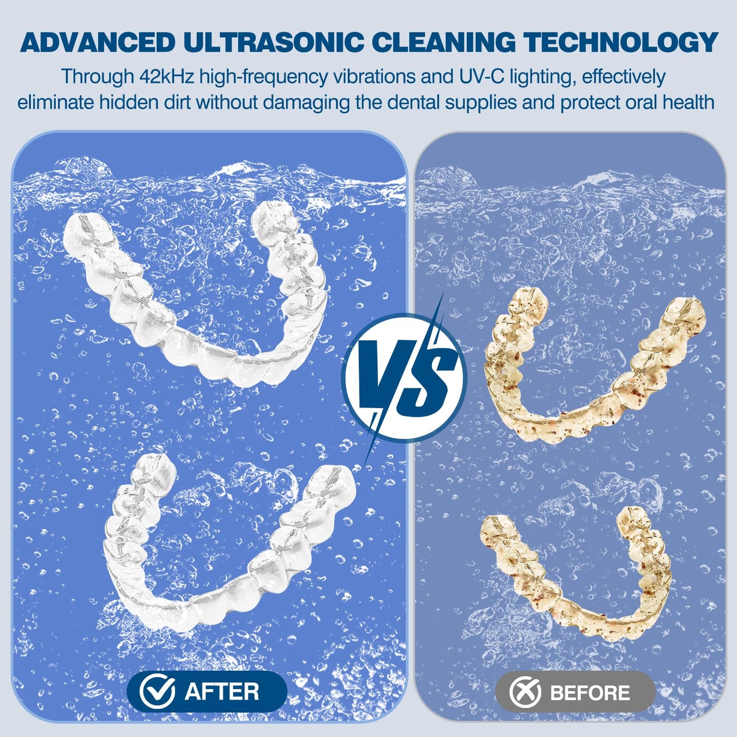 Ultrasonic Retainer Cleaner Machine - Professional 42KHz Dental Cleaning Pod for Dentures, Aligners, Night Guards & Jewelry - 180ml Sonic Cleaner