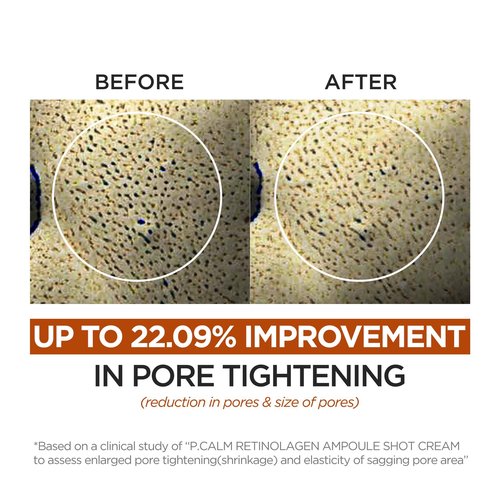 P.CALM Retinolagen Ampoule Shot Cream - Retinol & Vegan Hydrolyzed Collagen & Bakuchiol for Pore Tightening, Mositurizing, Korean Glass Skin (60ml / 2.02 fl.oz)