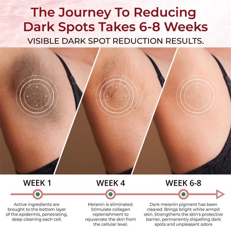 Abera Underarm Dark Spot Corrector Cream with Bearberry Extract, Targeted Armpit Spot Reducer & Sensitive Area Skin Tone Enhancer, Natural Even Tone Solution with Arbutin & Niacinamide