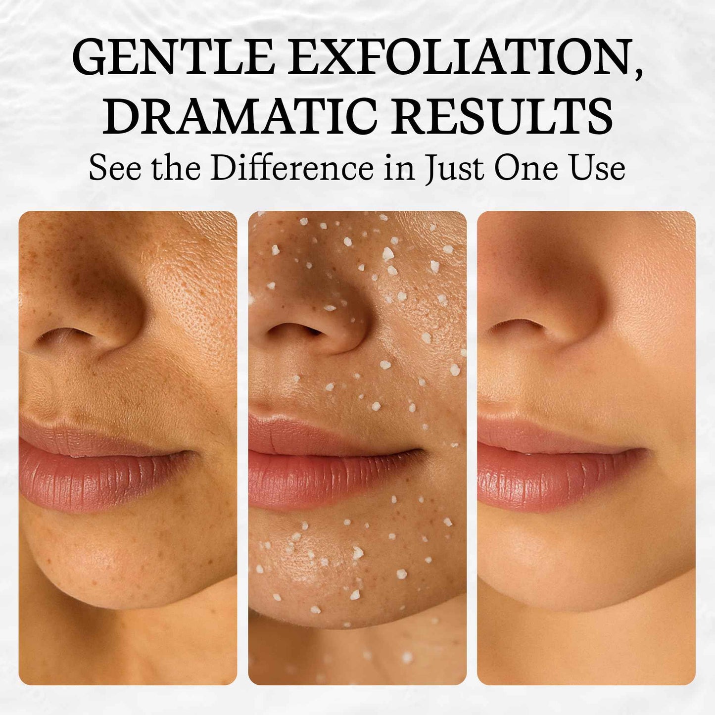 Vivo Per Lei Facial Peeling Gel - Contains Dead Sea Minerals and Nut Shell Powder - Gentle Face Exfoliator Scrub and Blackhead Remover - Peel Your Skin to a Fresher You - 4.05 Fl oz.