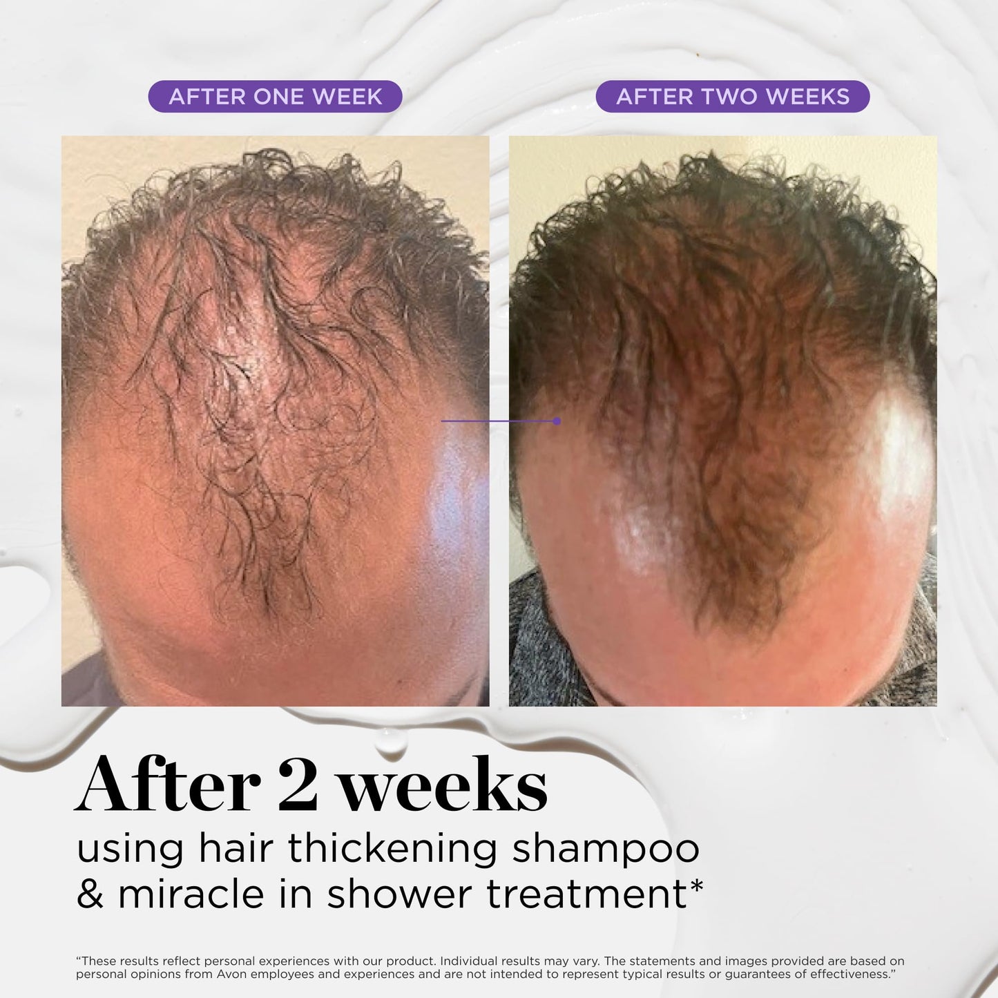Dr. Groot Miracle in Shower Moisturizing Treatment for Hair Loss, Korean Hair Care Rinse, Rosemary Oil for Smooth, Healthier-Looking Hair in 5 Seconds, Scalp Revitalizing Solution